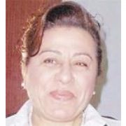 BENİM KOCAM YAPSA GÖZÜNÜ MORARTIRIM 